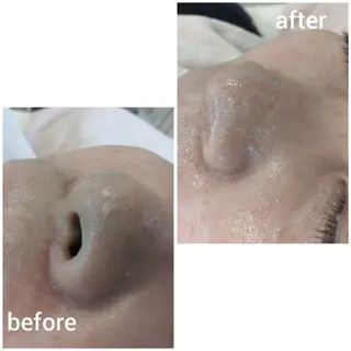 フェイシャルエステ ZELOSSALONのエステ・リラクイメージ