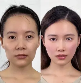 ネイル aliaハイフ&水光ジェットサロン所属・aliaハーブ水光店 エステティシャン募集のエステ・リラクイメージ