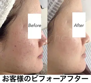 ショート カラー パーマ ヘアアレンジ ネイル マツエク・マツパ 都度払い肌質改善 &脱毛Blancheのエステ・リラクイメージ