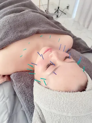 美容鍼＆鍼灸サロン 鍼Glitter.所属・田中 美奈のエステ・リラクイメージ