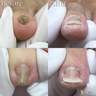 ネイル 東京巻き爪アカデミー所属・東京巻き爪 アカデミーのエステ・リラクイメージ