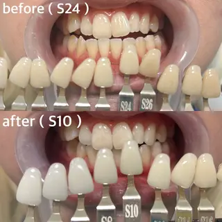 メンズ 九州オーラルホワイトニング所属・田中 毬亜/薬院警固店のエステ・リラクイメージ