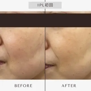 【小顔・毛穴ケア】 セラピスト 和田紋子のエステ・リラクイメージ