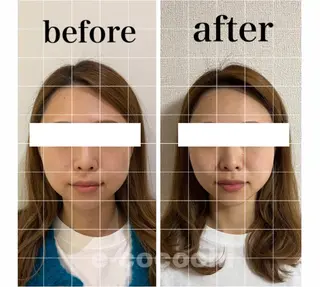 小顔と ヘッドスパのお店のエステ・リラクイメージ