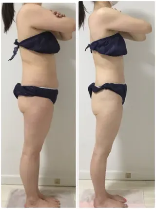 オールハンド痩身 te&te  テトテのエステ・リラクイメージ