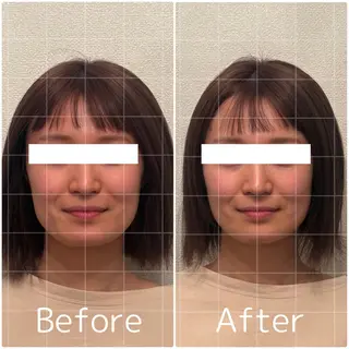 Lily luce 美骨小顔矯正のその他イメージ