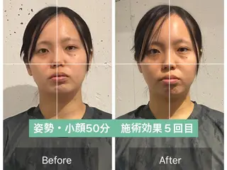美容整体 小顔矯正 プラスフィール飯野のエステ・リラクイメージ