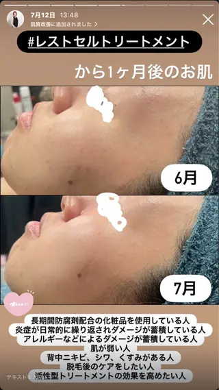 LiZA エステティックサロンのエステ・リラクイメージ