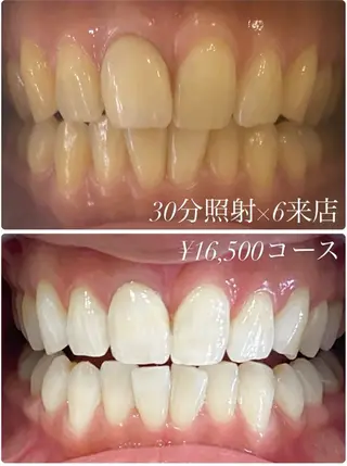 ホワイトニングルーム　川崎店所属・ホワイトニング ルーム　川崎店のその他イメージ