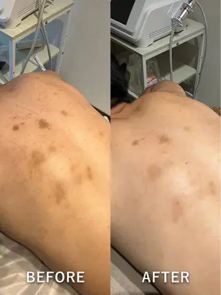 # fu♡のエステ・リラクイメージ