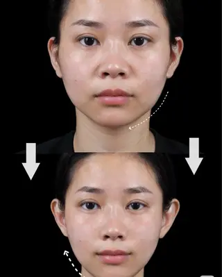 マツエク・マツパ aliaハイフ&水光ジェットサロン所属・aliaハーブ水光店 エステティシャン募集のエステ・リラクイメージ