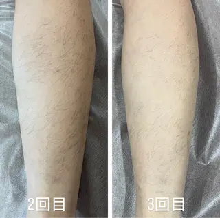 てらもと ほのかのエステ・リラクイメージ