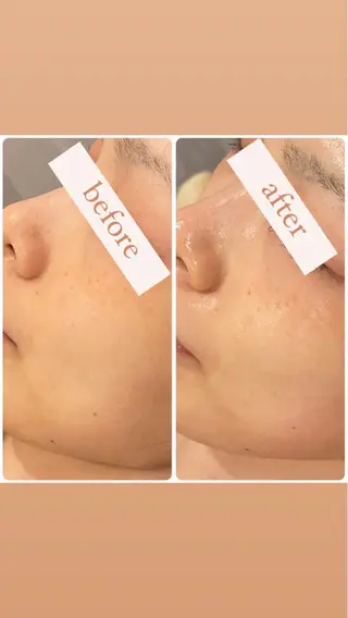 立体小顔×艶肌×美ボ ディ似合わせ施術 岡のエステ・リラクイメージ