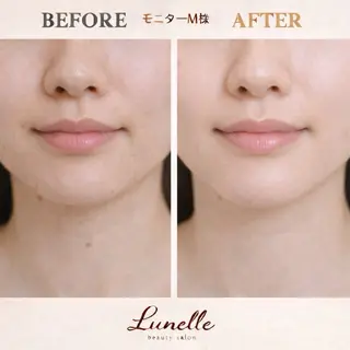 脱毛×肌管理サロン ルネルのエステ・リラクイメージ