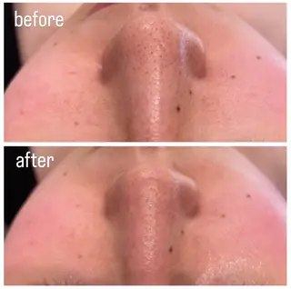 TotalBeautySalon UNCHEL所属・Ito ayakaのマツエク・マツパデザイン