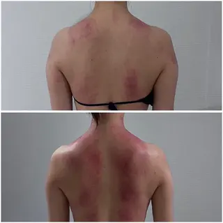 LibCharm🩰 村山美咲のエステ・リラクイメージ