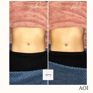 salon shares 辻堂店所属・SHARES AOIのエステ・リラクイメージ