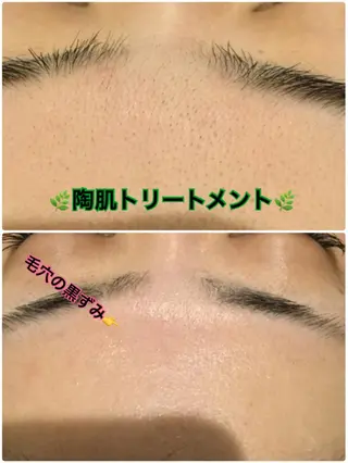 【リベルハーブピーリング認定店】敏感肌・美白脱毛専門店Dione立川店所属・Dione 立川店のエステ・リラクイメージ