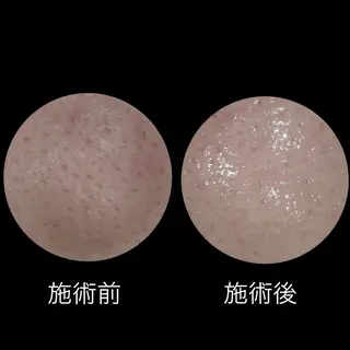 メナードフェイシャルサロン丸の内ヒルズ所属・メナード丸の内ヒルズ 柳田りさのエステ・リラクイメージ