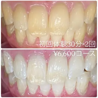 PLATINUM Beauty 横浜店所属・ホワイトニングルーム 横浜店のその他イメージ