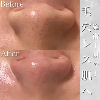 Rumia esthetic salon所属・芯美 -shinbi-のエステ・リラクイメージ