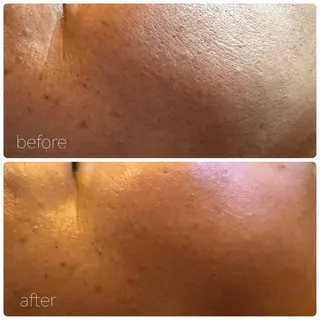 HALU _HARUのエステ・リラクイメージ