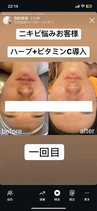 西区九条エステ MITUREIサロンのエステ・リラクイメージ