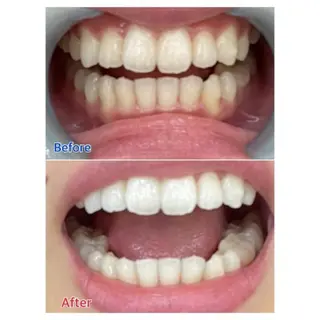 M渋谷店所属・Ｍ渋谷 ホワイトニングのエステ・リラクイメージ