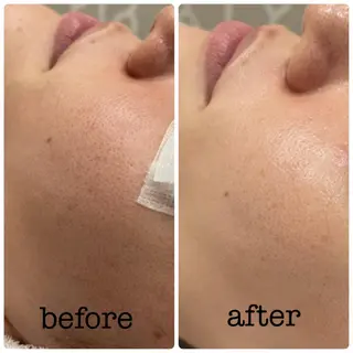 エターナルビューティー各務原店所属・土屋 絵里奈のエステ・リラクイメージ