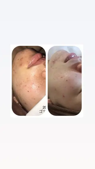 【足圧】鬼👹リンパ 身体整うサロンのエステ・リラクイメージ