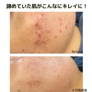 leolo武蔵浦和 肌質改善＆脱毛のエステ・リラクイメージ