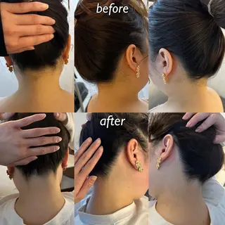 うなじ脱毛/美肌脱毛 LABELのエステ・リラクイメージ