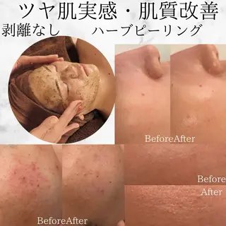 Ginza Charerのエステ・リラクイメージ