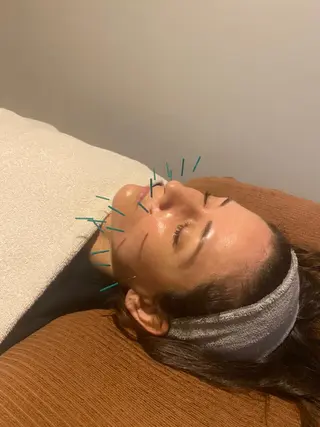 Relama　美容鍼×マッサージ所属・Relama/リラマ 美容鍼×マッサージのエステ・リラクイメージ