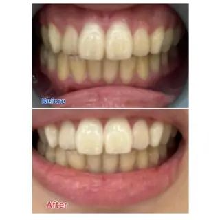 M渋谷店所属・Ｍ渋谷 ホワイトニングのエステ・リラクイメージ