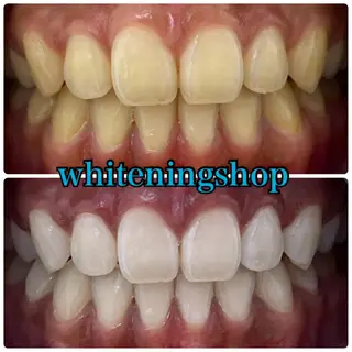 ホワイトニング ショップ吉祥寺店のエステ・リラクイメージ