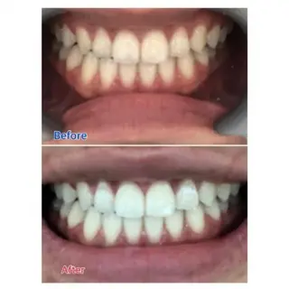 M渋谷店所属・Ｍ渋谷 ホワイトニングのエステ・リラクイメージ