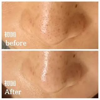 フェイシャル専門サロ ン　ERINのエステ・リラクイメージ