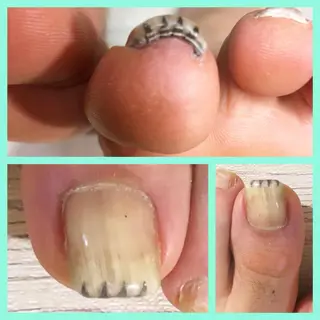 メンズ ネイル 🌱 ま し お 🌱のその他イメージ