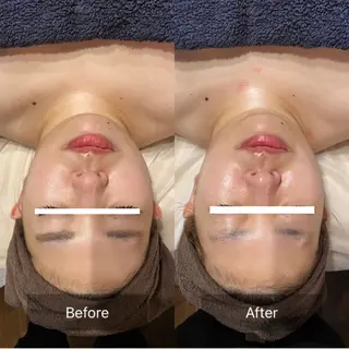 lumière d’espoirのエステ・リラクイメージ