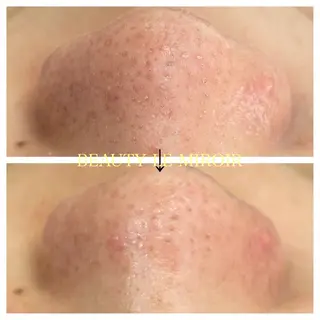 ビューティー ミロワールのエステ・リラクイメージ