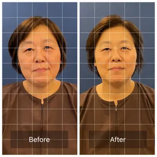 美容鍼　蒼月-aotsuki-所属・美容鍼「蒼月」 -アオツキ-のエステ・リラクイメージ