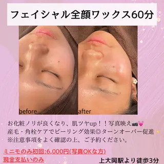 眉毛×小顔矯正サロン パピヨンsakiのエステ・リラクイメージ