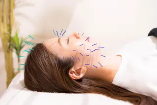 美容鍼・小顔/ 骨盤矯正/目黒/レンのエステ・リラクイメージ