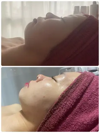 Chalon所属・REVI取扱・肌悩み 毛穴Chalonのエステ・リラクイメージ