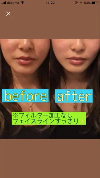 小顔矯正・美容鍼 美鍼堂のエステ・リラクイメージ