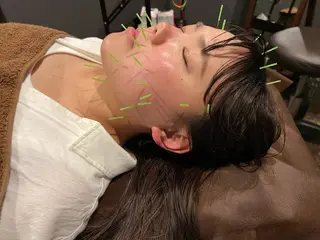 メンズ 美容鍼灸サロン LOMIHARIのエステ・リラクイメージ