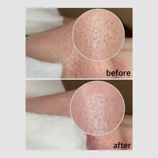 韓国肌管理 【毛穴専科】のエステ・リラクイメージ