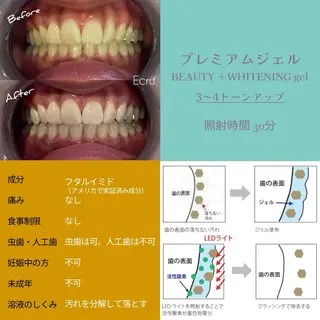 メンズ キッズ ホワイトニングサロン Ecru所属・ホワイトニングサロン Ecru エクリュのエステ・リラクイメージ