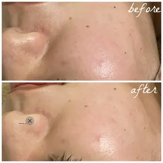 メンズ メナード岐阜市茜部 杉浦のエステ・リラクイメージ